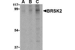 Western Blotting (WB) image for anti-BR serine/threonine Kinase 2 (BRSK2) (C-Term) antibody (ABIN1030303) (BRSK2 Antikörper  (C-Term))