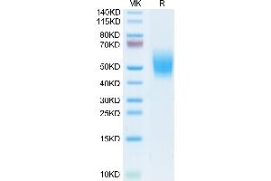 Cynomolgus DNAM-1 on Tris-Bis PAGE under reduced condition. (CD226 Protein (CD226) (AA 19-252) (His tag))