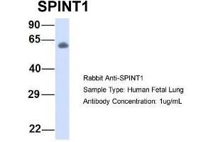 Host:  Rabbit  Target Name:  SPINT1  Sample Type:  Human Fetal Lung  Antibody Dilution:  1. (SPINT1 Antikörper  (Middle Region))