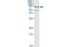 Western Blotting (WB) image for anti-Phosphoglucomutase 3 (PGM3) (AA 1-543) antibody (ABIN598868) (Phosphoglucomutase 3 Antikörper  (AA 1-543))