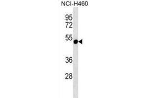 Western Blotting (WB) image for anti-Rhabdoid Tumor Deletion Region Gene 1 (RTDR1) antibody (ABIN2997232) (RTDR1 Antikörper)