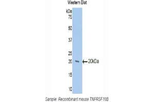 Western blot analysis of the recombinant protein. (TNFRSF10B Antikörper  (AA 233-367))