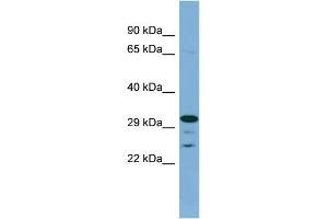WB Suggested Anti-DHRS9 Antibody Titration: 0. (DHRS9 Antikörper  (Middle Region))