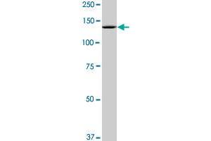 Western Blotting (WB) image for anti-Splicing Factor 3b, Subunit 2, 145kDa (SF3B2) (AA 1-636) antibody (ABIN524388)