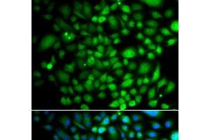 Immunofluorescence analysis of A549 cells using PTK6 Polyclonal Antibody (PTK6 Antikörper)