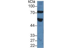 Western Blot; Sample: Human Serum; Primary Ab: 5µg/ml Rabbit Anti-Human FZD1 Antibody Second Ab: 0.