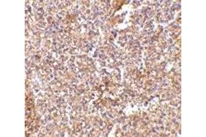 Immunohistochemistry (IHC) image for anti-Six Transmembrane Epithelial Antigen of The Prostate 1 (STEAP1) (Middle Region) antibody (ABIN1031108) (STEAP1 Antikörper  (Middle Region))