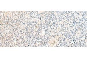 Immunohistochemistry of paraffin-embedded Human tonsil tissue using SNRPD1 Polyclonal Antibody at dilution of 1:70(x200) (SNRPD1 Antikörper)