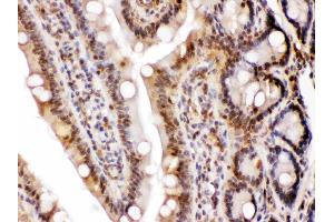 LDHA was detected in paraffin-embedded sections of rat intestine tissues using rabbit anti- LDHA Antigen Affinity purified polyclonal antibody (Catalog # ) at 1 ? (Lactate Dehydrogenase A Antikörper  (AA 2-106))