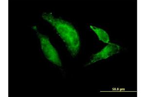 Immunofluorescence of purified MaxPab antibody to TBX20 on HeLa cell.