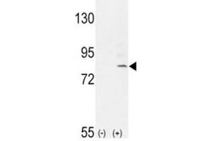 Western Blotting (WB) image for anti-Fibroblast Growth Factor Receptor 1 (FGFR1) (AA 285-314) antibody (ABIN3030941)