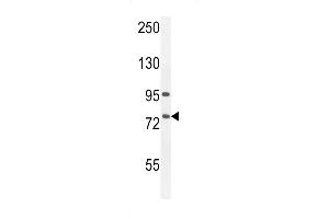 ALOX12B Antibody (C-term) (ABIN654058 and ABIN2843957) western blot analysis in A549 cell line lysates (35 μg/lane).