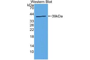 Western blot analysis of the recombinant protein. (SLC6A3 Antikörper  (AA 562-620))