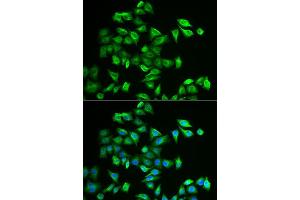Immunofluorescence analysis of A549 cells using POMGNT2 antibody (ABIN5973878). (C3orf39 Antikörper)