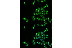 Immunofluorescence analysis of HeLa cell using CSNK1A1L antibody. (CSNK1A1L Antikörper)
