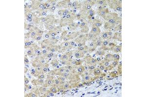 Immunohistochemistry of paraffin-embedded human liver injury using OSGEPL1 antibody at dilution of 1:100 (x40 lens). (OSGEPL1 Antikörper)