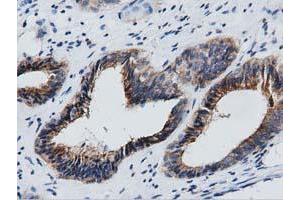 Immunohistochemical staining of paraffin-embedded Human Kidney tissue using anti-GAS7 mouse monoclonal antibody. (GAS7 Antikörper)