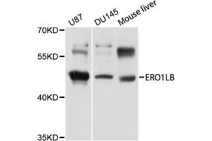 Western blot analysis of extracts of various cell lines, using ERO1LB antibody (ABIN5971901) at 1/1000 dilution. (ERO1LB Antikörper)