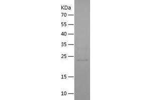 ULBP2 Protein (AA 25-224) (His tag)