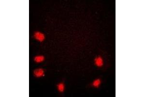 Immunofluorescent analysis of Rpb1 CTD staining in HeLa cells. (Rpb1 CTD Antikörper  (C-Term))