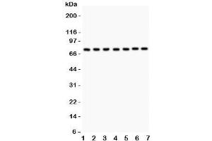 Western blot testing of GCLC antibody and Lane 1:  rat brain;  2: (r) heart;  3: human HeLa;  4: (r) PC12;  5: (r) NRK;  6: mouse HEPA;  7: (h) A549. (GCLC Antikörper  (AA 437-637))