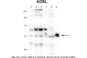 Sample Type: 1. (Adenylosuccinate Lyase Antikörper  (Middle Region))