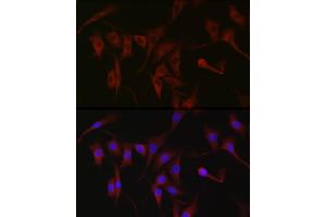 Immunofluorescence analysis of NIH/3T3 cells using PKC zeta Rabbit pAb (ABIN6128468, ABIN6146211, ABIN6146213 and ABIN6221376) at dilution of 1:100 (40x lens). (PKC zeta Antikörper  (AA 453-592))