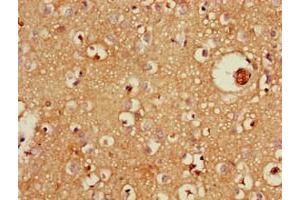 Immunohistochemistry of paraffin-embedded human brain tissue using ABIN7176064 at dilution of 1:100 (ZFYVE26 Antikörper  (AA 2306-2473))