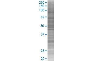 PDYN transfected lysate. (PDYN 293T Cell Transient Overexpression Lysate(Denatured))