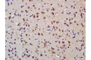 Formalin-fixed and paraffin embedded rat brain labeled with Anti-Melanoregulin Polyclonal Antibody, Unconjugated  at 1:200 followed by conjugation to the secondary antibody and DAB staining (MREG Antikörper  (AA 120-160))