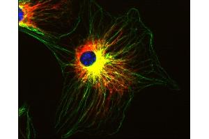 Immunofluorescence staining of 3T3 mouse embryonal fibroblast cell line using anti-alpha-tubulin (TU-01 ; green) and anti-Vimentin (VI-01; red). (alpha Tubulin Antikörper)