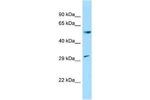 WB Suggested Anti-Ccnl1 Antibody Titration: 1.