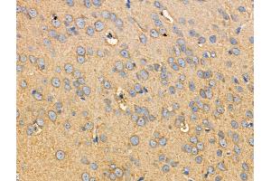 ABIN6255025 and ABIN6266462 at 1/100 staining Rat brain tissue by IHC-P. (RIPK2 Antikörper  (pSer176))