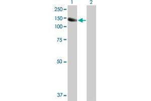 Western Blot analysis of PTK2B expression in transfected 293T cell line by PTK2B MaxPab polyclonal antibody.