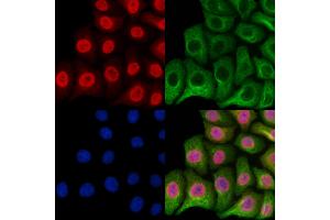 ABIN6257252 and ABIN6273611 staining Hela cells by IF/ICC.