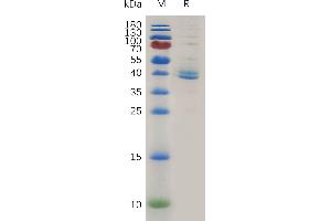 SDS-PAGE (SDS) image for Transforming Growth Factor, beta Receptor 1 (TGFBR1) (AA 34-126) protein (Fc Tag) (ABIN7491079)