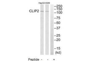 Western blot analysis of extracts from HepG2 cells and A549 cells, using CLIP2 antibody. (CLIP2 Antikörper  (C-Term))