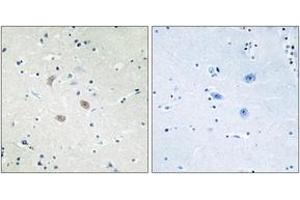 Immunohistochemistry analysis of paraffin-embedded human brain tissue, using Akt2 (Ab-474) Antibody. (AKT2 Antikörper  (AA 432-481))