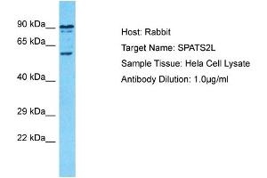 Host: Rabbit Target Name: SPATS2L Sample Type: Hela Whole Cell lysates Antibody Dilution: 1. (SPATS2L Antikörper  (C-Term))