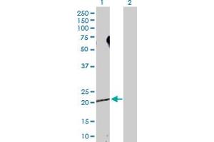 Western Blot analysis of SDCBP expression in transfected 293T cell line by SDCBP MaxPab polyclonal antibody. (SDCBP Antikörper  (AA 1-298))