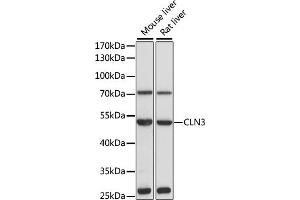 Western blot analysis of extracts of various cell lines, using CLN3 antibody (ABIN3015724, ABIN3015725, ABIN1679284 and ABIN6219075) at 1:1000 dilution. (CLN3 Antikörper  (AA 1-280))