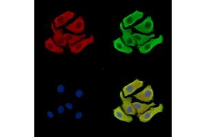 ABIN7096279 and ABIN7100341 staining Hela cells by IF/ICC.