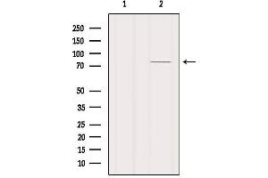 Western blot analysis of extracts from Mouse lung, using MAGC3 Antibody. (MAGEC3 Antikörper)