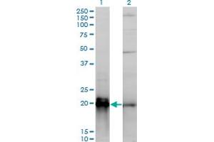 Western Blot analysis of KRAS expression in transfected 293T cell line by KRAS monoclonal antibody (M01), clone 3B10-2F2.