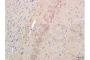Formalin-fixed and paraffin embedded rat hippocampus labeled with Anti-Nestin Polyclonal Antibody (ABIN723530), Unconjugated 1:300 followed by conjugation to the secondary antibody and DAB staining (Nestin Antikörper  (AA 681-750))