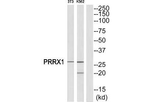 Western Blotting (WB) image for anti-Paired Related Homeobox 1 (PRRX1) (Internal Region) antibody (ABIN1851770) (PRRX1 Antikörper  (Internal Region))