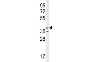Western Blotting (WB) image for anti-Caspase 12 (Gene/pseudogene) (CASP12) (AA 165-193) antibody (ABIN3030291)