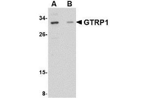 Western blot analysis of GRTP1 in SK-N-SH cell lysate with AP30388PU-N GRTP1 antibody at 1 μg/ml in the (A) absence and (B) presence of blocking peptide.