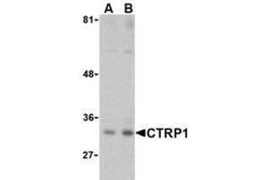 Western blot analysis of CTRP1 in MDA-MD-361 cell lysate with AP30246PU-N CTRP1 (IN) antibody at (A) 1 and (B) 2 μg/ml.
