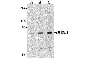 Western Blotting (WB) image for anti-DEAD (Asp-Glu-Ala-Asp) Box Polypeptide 58 (DDX58) antibody (ABIN2476365) (DDX58 Antikörper)